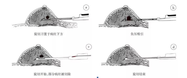 7月22日 云南省第一人民医院甲状腺、乳腺外科专家在丽江市人民医院坐诊 限号20个 (3).png