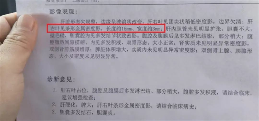 手术后15毫米针头落在体内，医院建议不取？多方回应！2.jpg