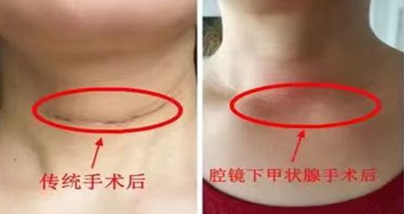 7月22日 云南省第一人民医院甲状腺、乳腺外科专家在丽江市人民医院坐诊 限号20个 (2).png