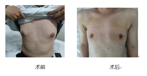 7月22日 云南省第一人民医院甲状腺、乳腺外科专家在丽江市人民医院坐诊 限号20个 (4).png