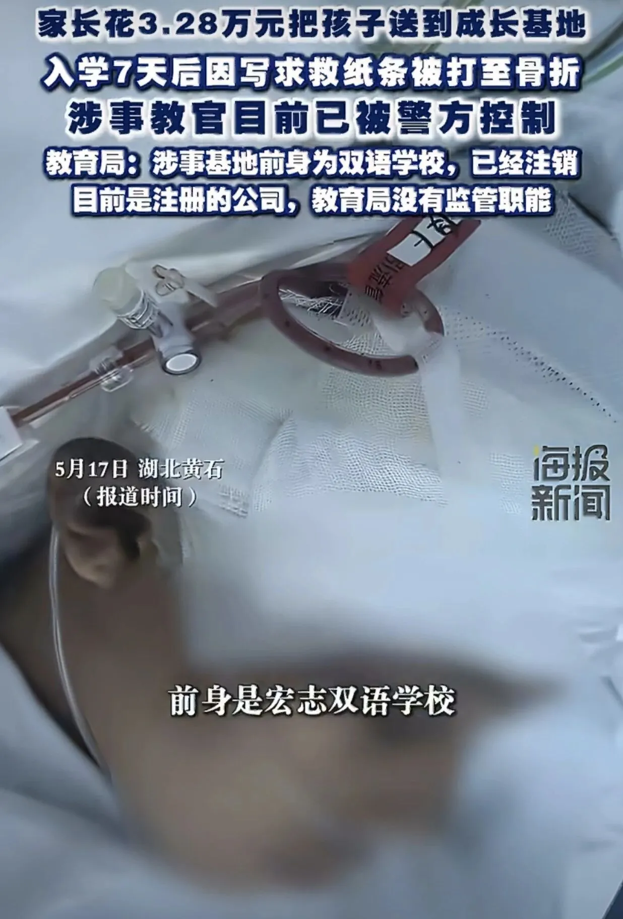 172035syzwr0ff9fcb0fwr.webp